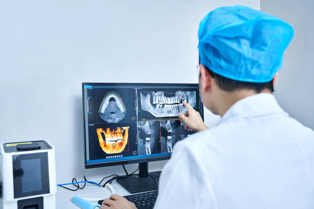 Best Emergency Wisdom Teeth Removal in Boiling Spring Lakes, NC